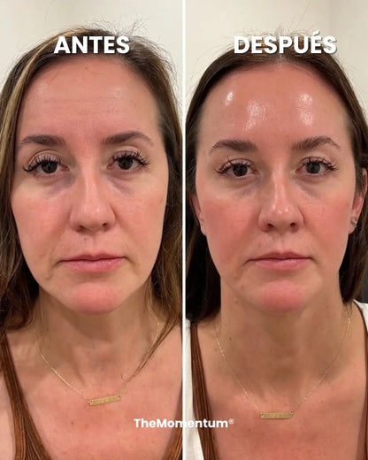 The Lift Pro®: Dispositivo de lifting facial real, firmeza visible y una piel que vuelve a sentirse tuya.